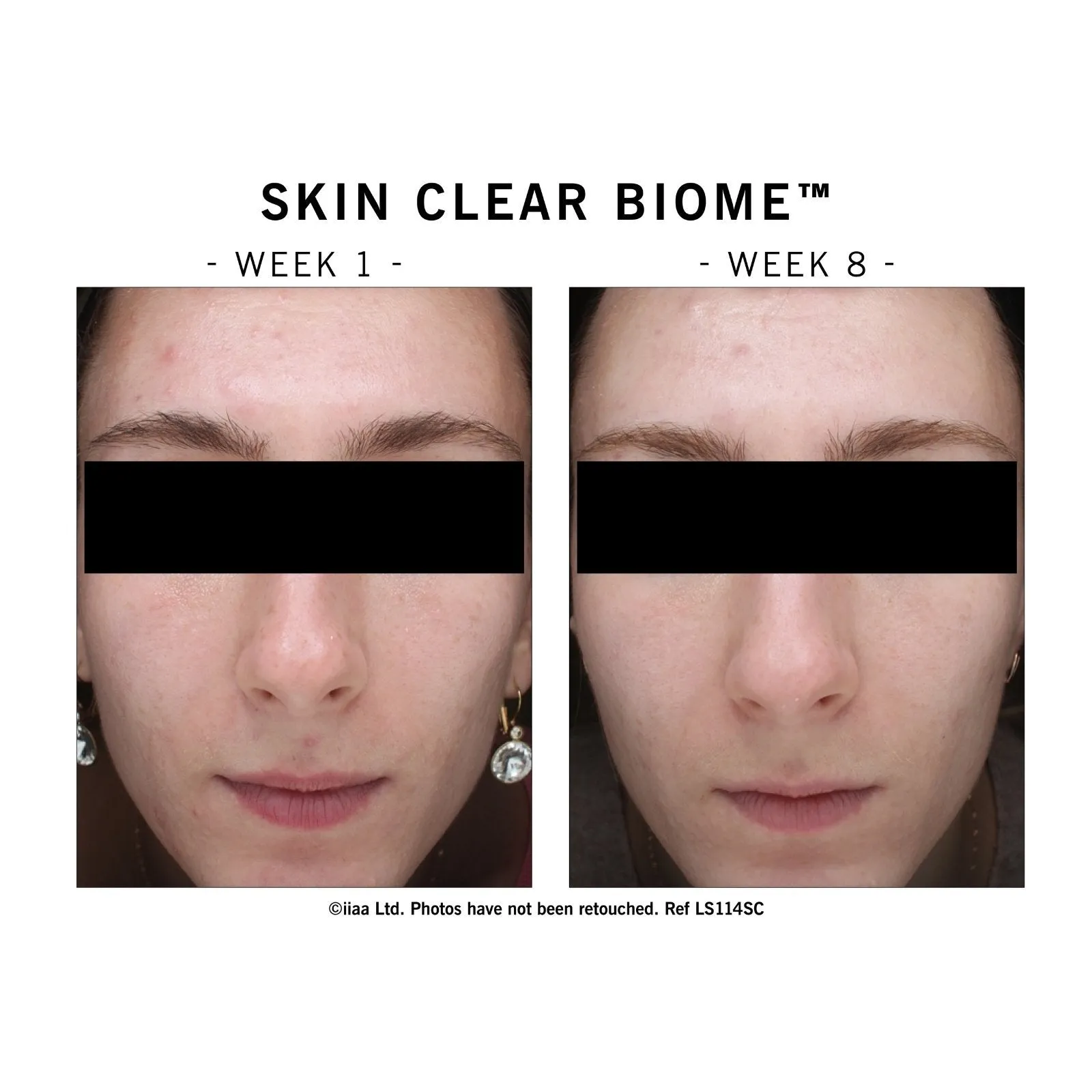 Skin Clear Biome Dietary Supplement 60 Capsules